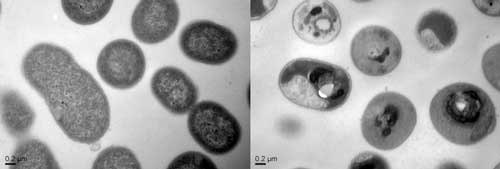 Normal cells of the Acinetobacter baumannii bacteria before (left) and after (right) treatment with the polymers