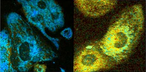 Cell Fluorescence Reveals Metabolic Activity