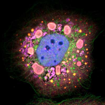 Reovirus-infected Epithelial Cell