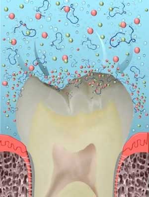 tooth repair