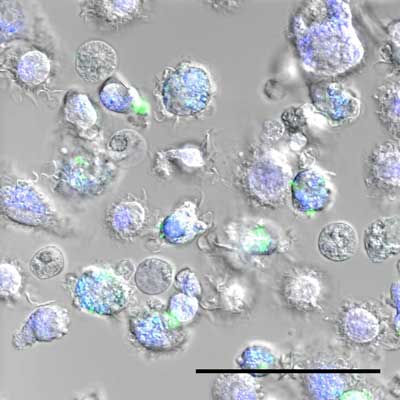 Immune cells that ingested spider silk nanoparticles