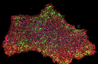 pluripotent stem cell colonies stained for pluripotency marker expression