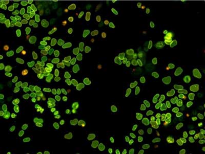 Embryonic Stem Cells Expressing a Fluorescent Timer