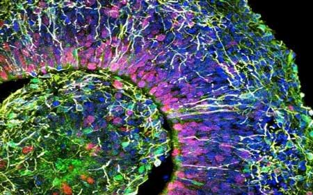 False color image of a slice of human brain organoid