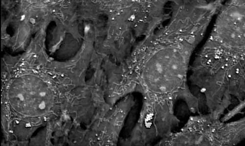 microscopy image od Pre-adipocytes