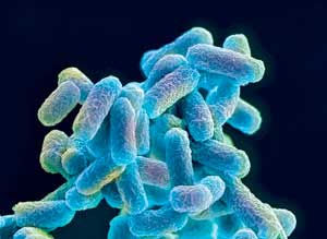 Escherichia coli bacteria