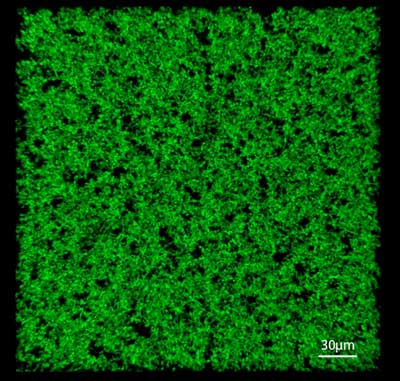 Porous Elastin-Based Network