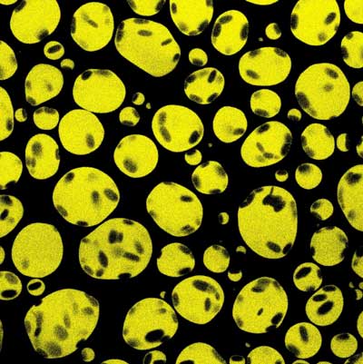 Fluorescent microscopy image of liquid-like droplets (yellow) formed of poly-L-lysine, DNA (dark spots), and adenosine triphosphate