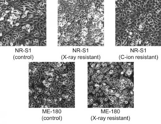 representative microscopic images of cancer cells and radioresistant cells