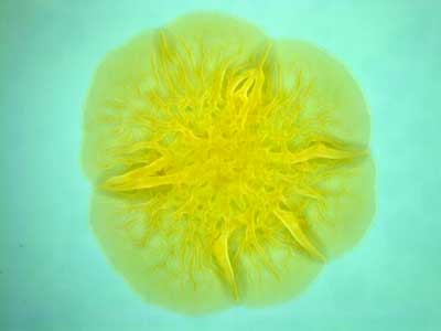 Bacterial Biofilm