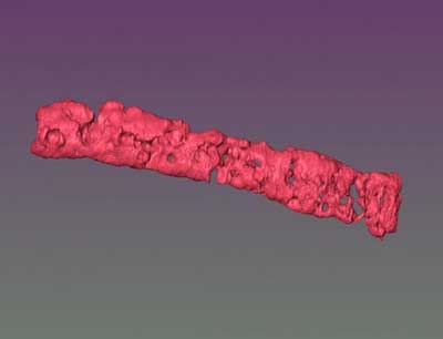 magnetic resonance imaging compilation of a porous strand