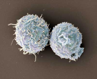 T Cells Lacking Coronin 1