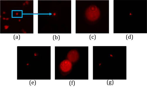 3D recording of lung cancer cells