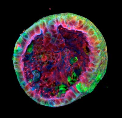 A kidney organoid