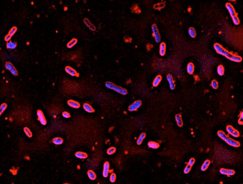 Microscopic N. aromaticivorans bacteria