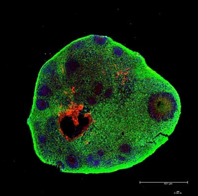 Brain Organoid