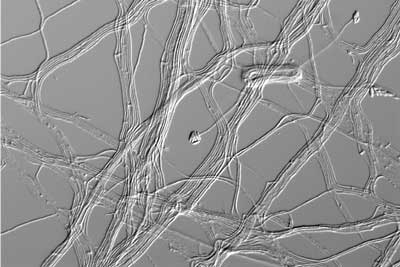 Acremonium egyptiacum under a microscope