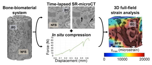 Full-Field Strain Analysis of Bone–Biomaterial Systems