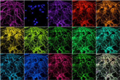 Imaging Synapses