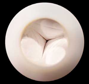 heart valve scaffold