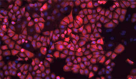 Staining of pulmonary basal cells