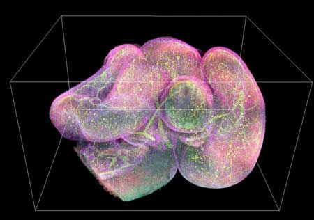 Fluorescence Imaging of a Mouse Intestine