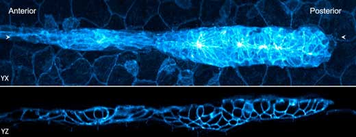 Fluorescence Imaging of a Zebrafish Embryo