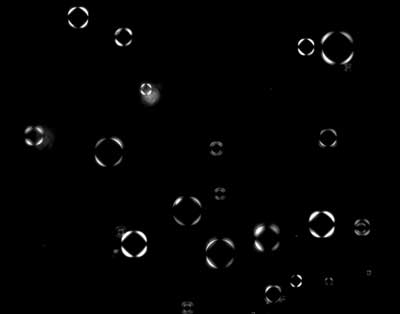 A polarization microscopy image of protein-RNA vesicles