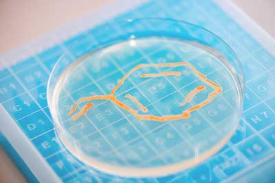 bacteria colony in a petri dish