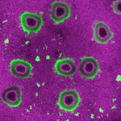 Confocal visualization of V. cholerae biofilms deforming a soft hydrogel substrate with embedded fluorescent particles