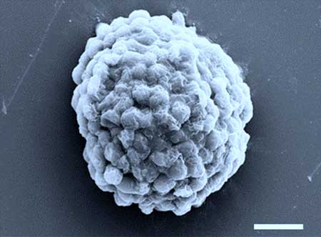 Electron microscopy image of a densely packed droplet of hydrogen-producing algal cells