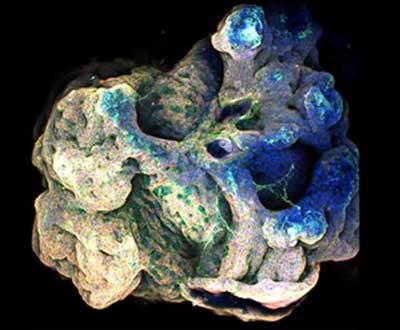 3D projection of a multi-organoid aggregate