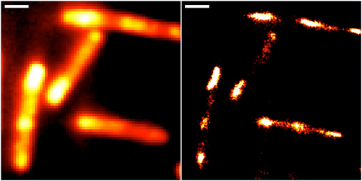 Conventional epifluorescence (left) and super-resolved localisation microscopy images of gut bacteria