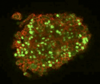 Human brain cancer cells cultured on the DN gel expressed a stem cell marker protein SOX 2 (green)