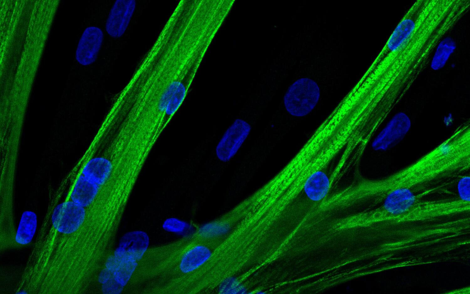 A myosin heavy chain is seen in green and the nuclei in blue