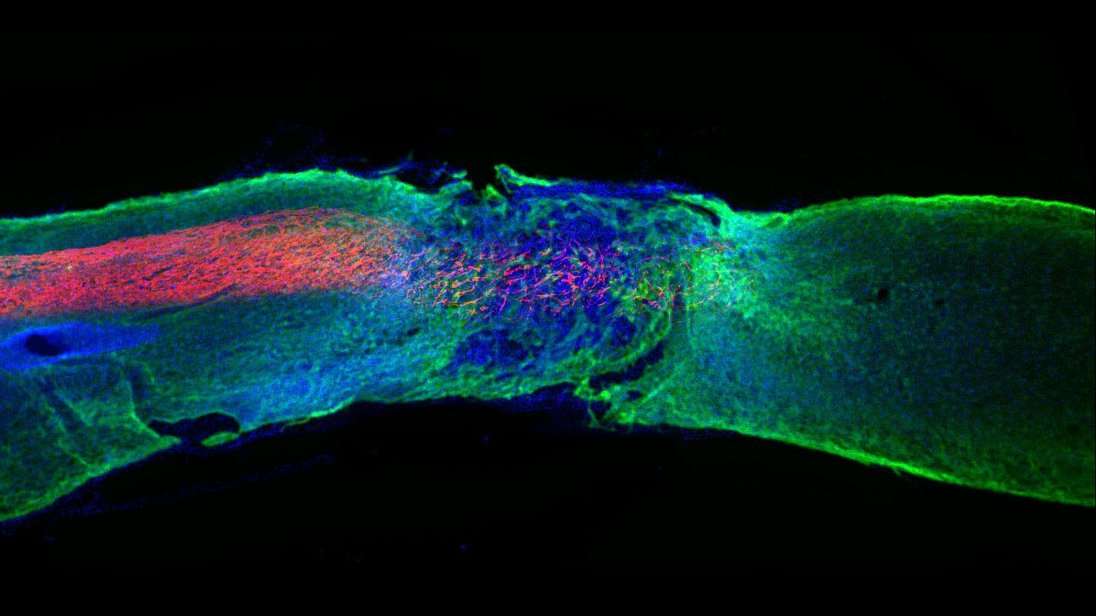 Axons (red) regenerated within a damaged area of the spinal cord