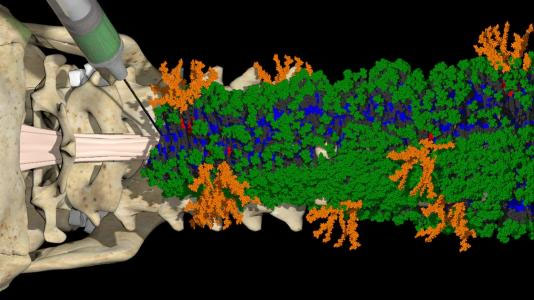 molecules form nanofibers to repair spinal cords