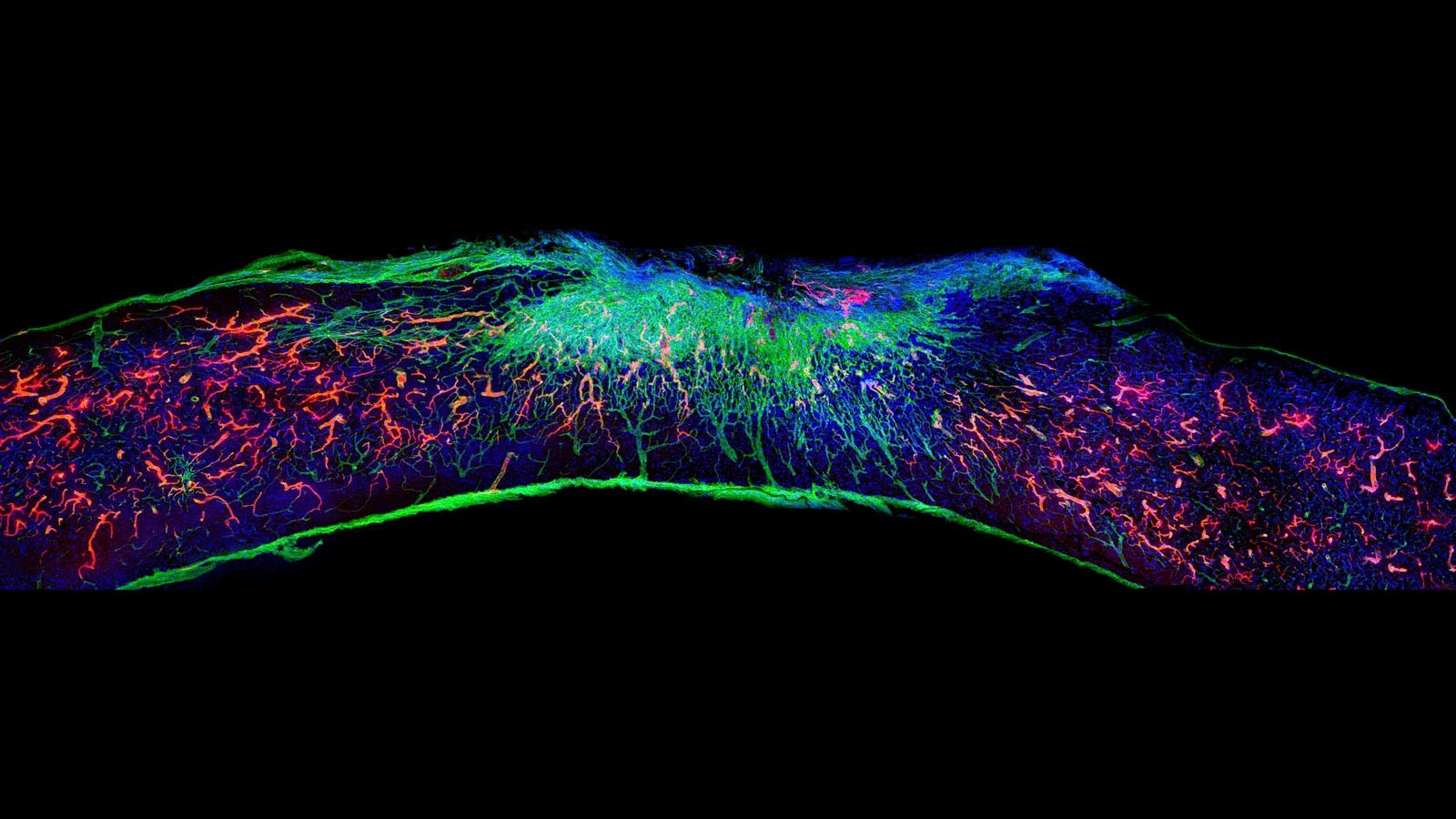Blood vessels (red) regrow inside a damaged spinal cord