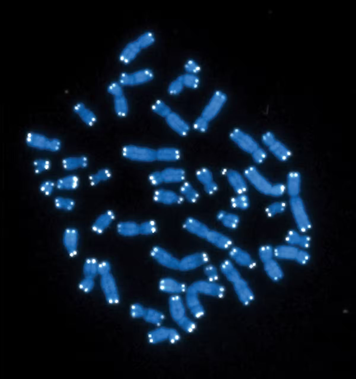 46 human chromosomes colored blue with white telomeres against a black screen