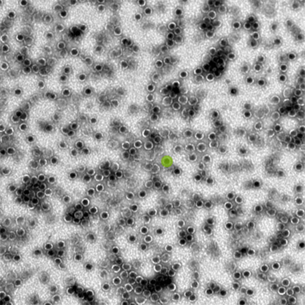 Each orb — one has been highlighted in lime green — is a bacterial microcompartment, about 40 nanometers in diameter