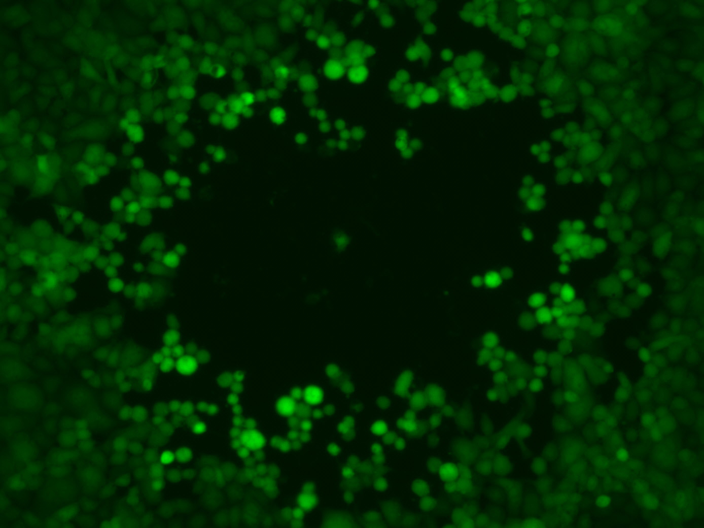 Plaque formation of cell culture cells by an engineered, green fluorescent herpes simplex virus 1