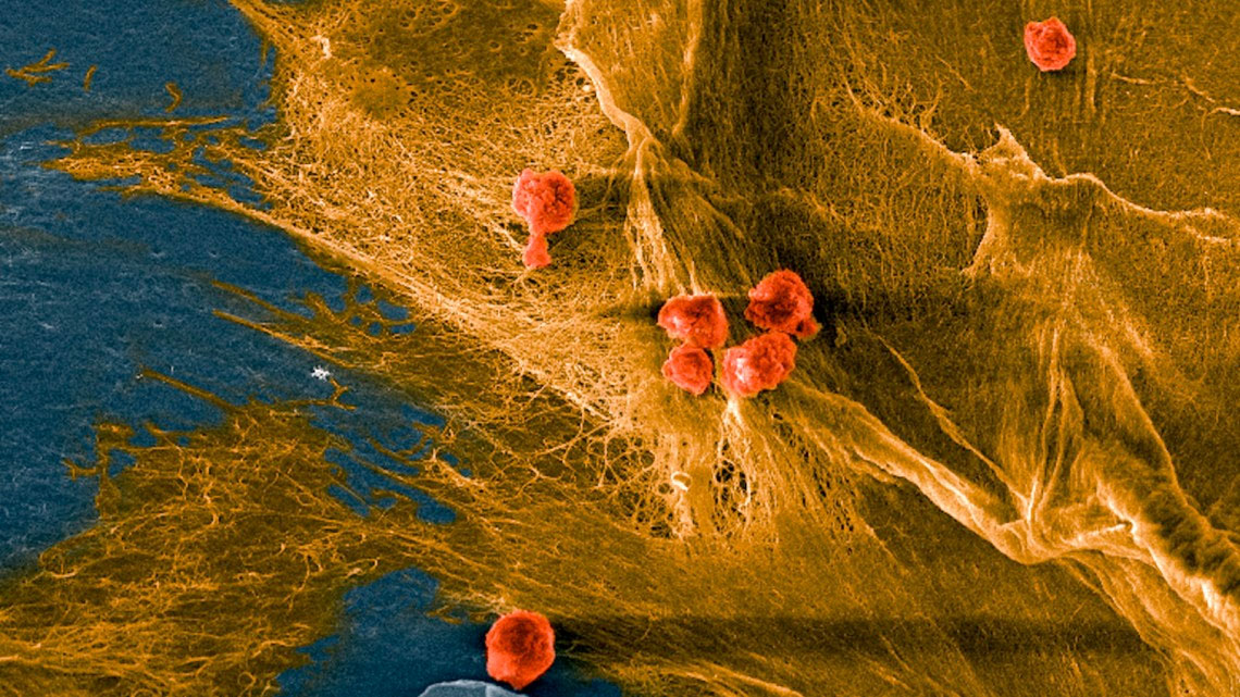 Micrograph of a biohybrid composite material showing cells (red) seeded on the fibrous domains (yellow) of collagen