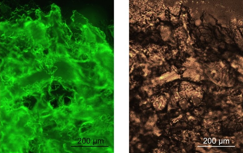 hydrogels stained with a fluorescent dye