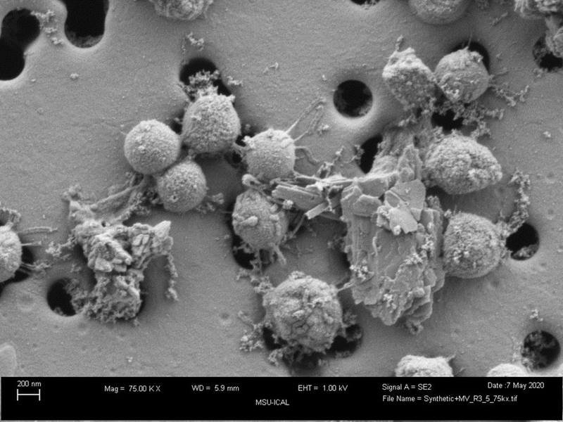 Electron micrograph of the microorganism Methanococcus voltae grown with pyrite