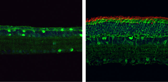 Gene editing prevents photoreceptor degeneration in mice