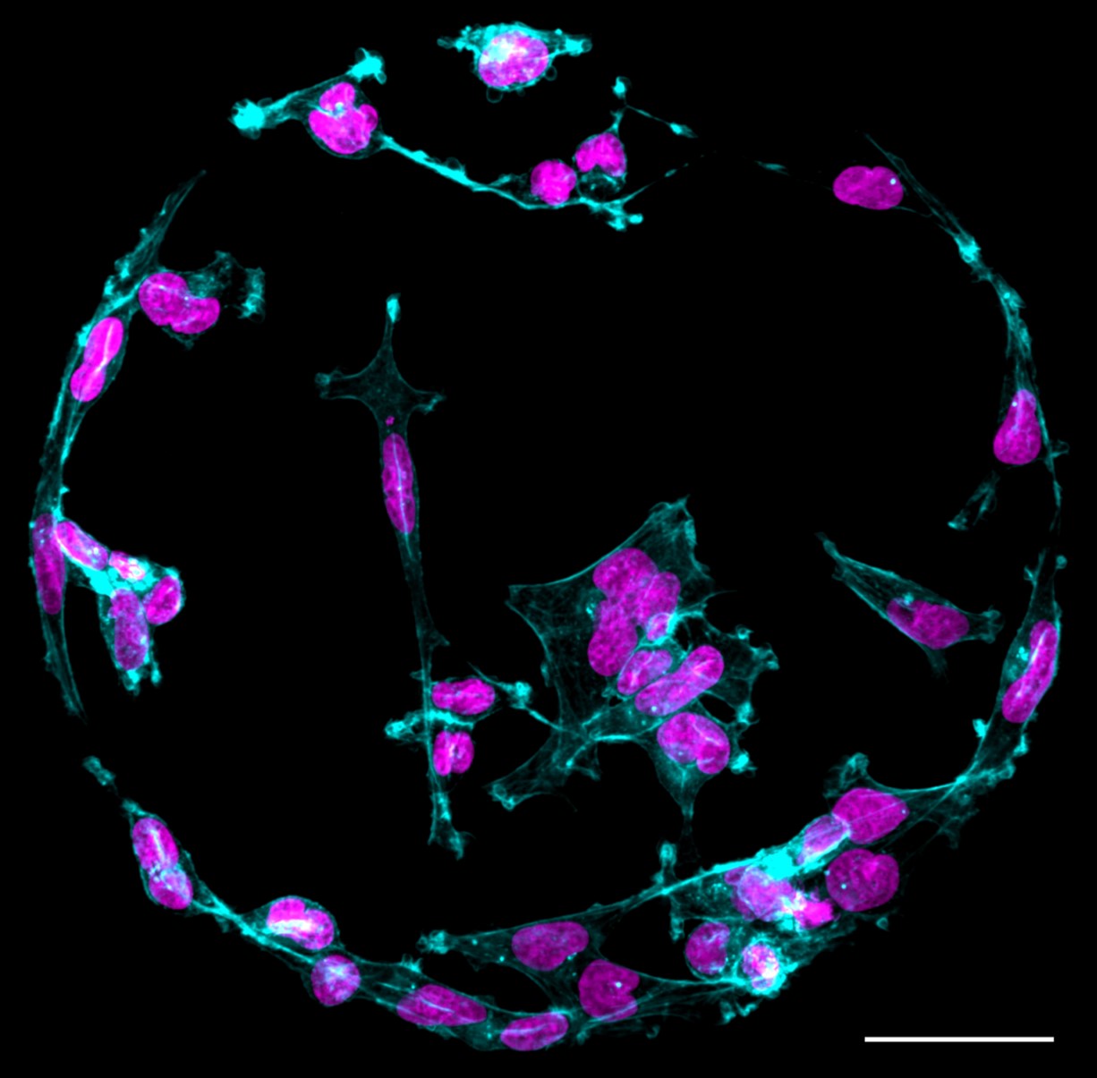 Figure showing cancer cells on a printed protein spot