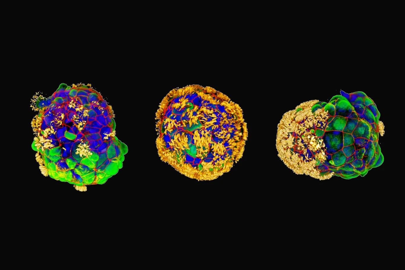 Three examples of Anthrobots with hair-like cilia in yellow