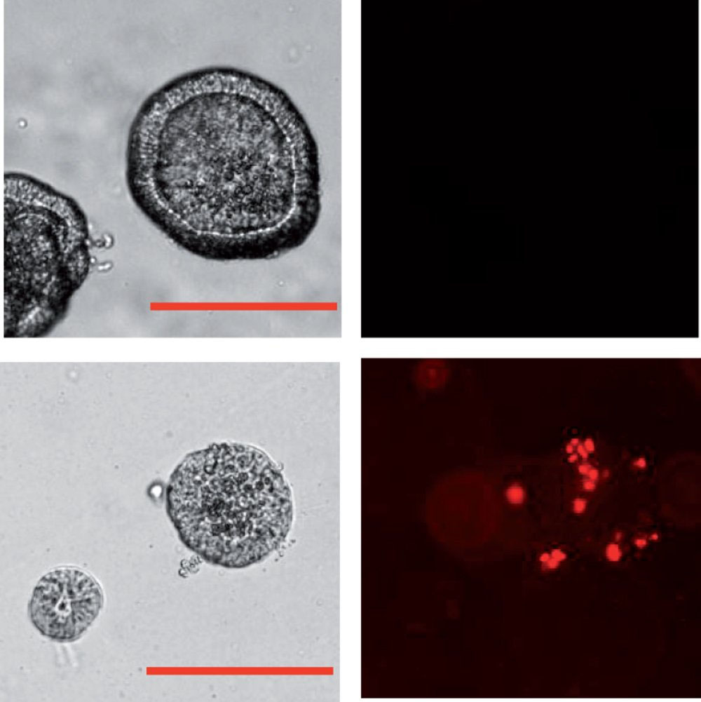 tumor cells