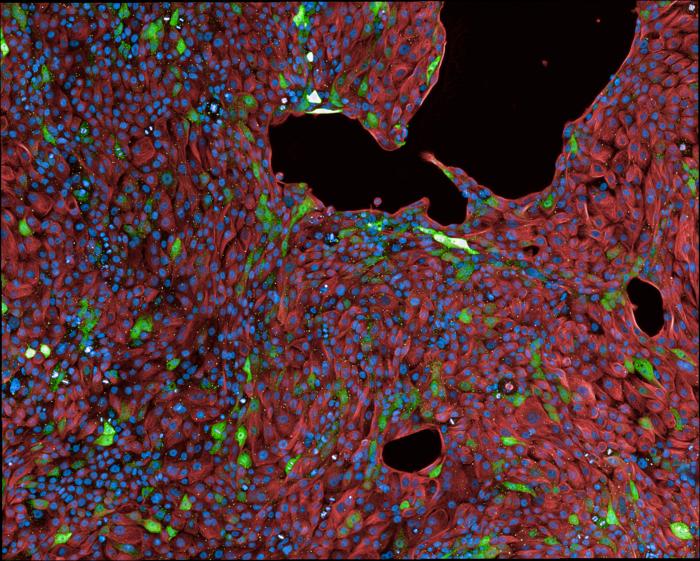 Decoding SARS-CoV-2 response in lung cells