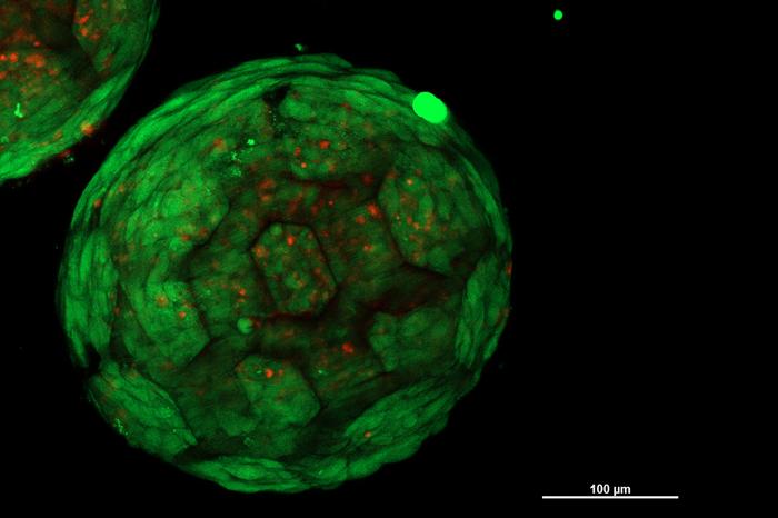 3D-printed spheroid, filled with living cells